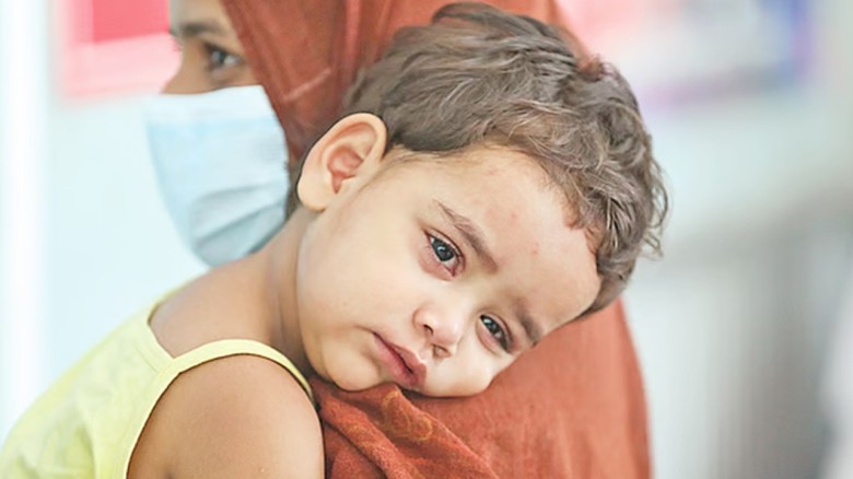 হামে ২৪ ঘণ্টায় আরও ৩ মৃত্যু, আক্রান্ত ৯৪৭