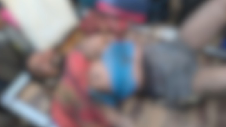 মোল্লাহাটে মাছ চুরির অভিযোগে চোখ উপড়ে ফেলার চেষ্টা