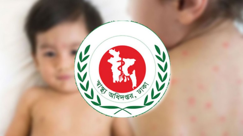 হাম ও উপসর্গে আরও ৭ শিশুর মৃত্যু