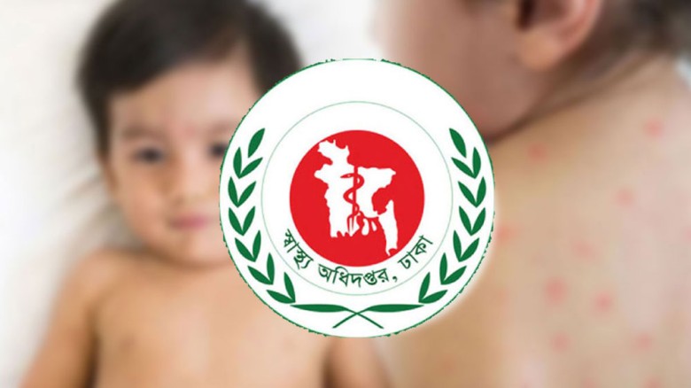 হাম ও উপসর্গে ১২ শিশুর মৃত্যু