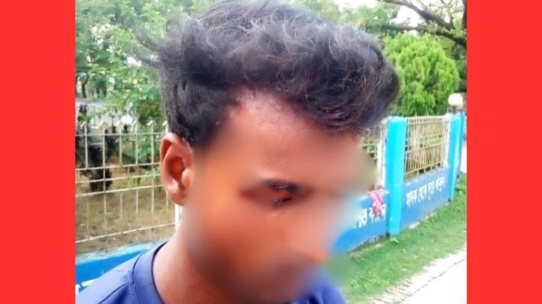 গ্রাম্য বিরোধে মাথা ফাটালো যুবকের