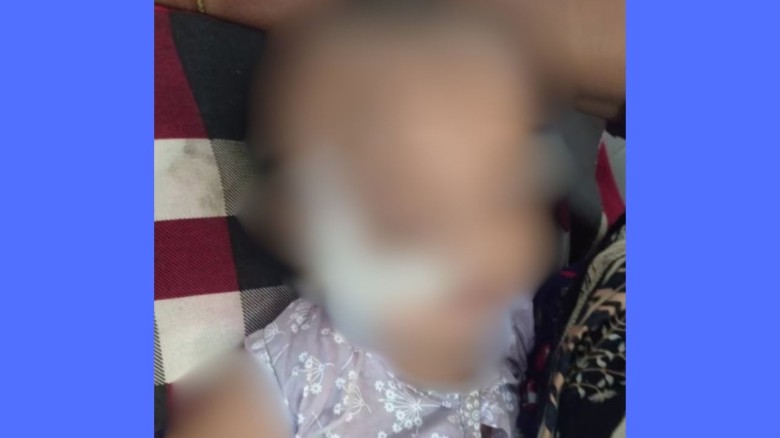 বেতাগীতে হামে আক্রান্ত শিশুর মৃত্যু