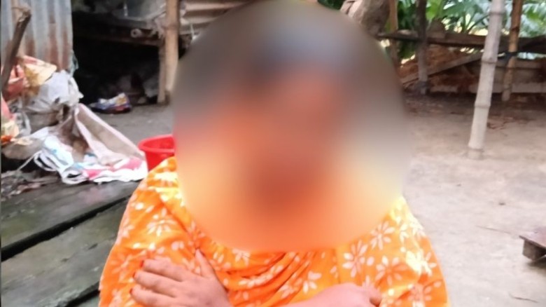 নাগরপুরে বুদ্ধি প্রতিবন্ধী নারীকে ধর্ষণ: থানায় মামলা
